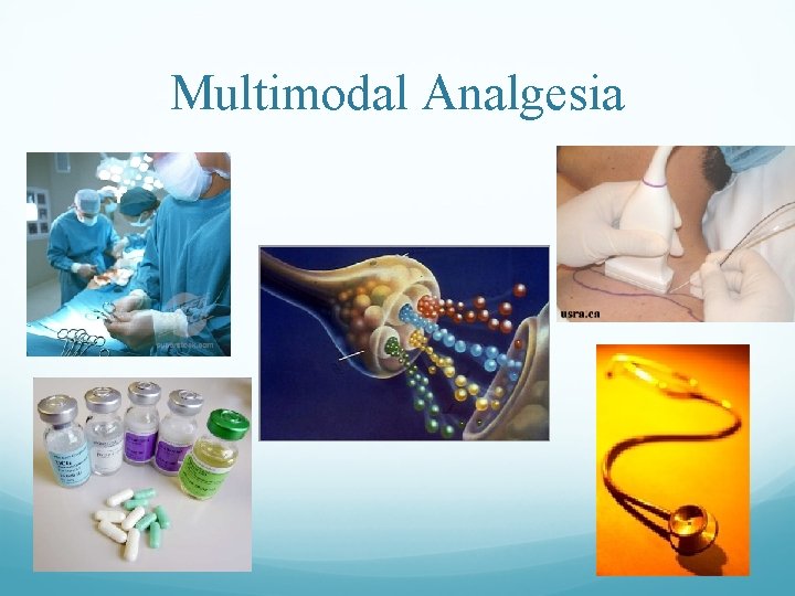 Multimodal Analgesia 