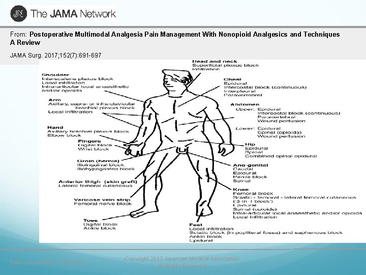 From: Postoperative Multimodal Analgesia Pain Management With Nonopioid Analgesics and Techniques A Review JAMA