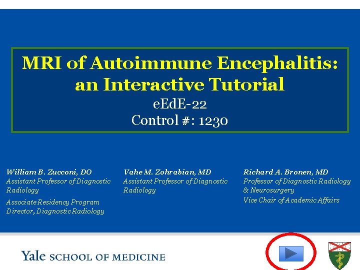 MRI of Autoimmune Encephalitis: an Interactive Tutorial e. Ed. E-22 Control #: 1230 William
