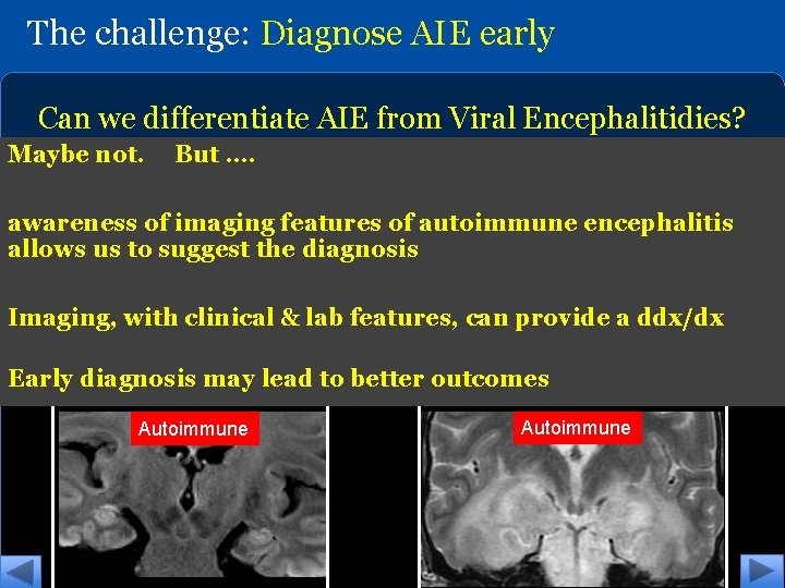 The challenge: Diagnose AIE early Can we differentiate AIE from Viral Encephalitidies? Which of