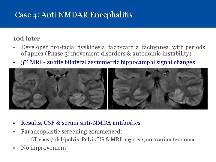 Case 4: Anti NMDAR Encephalitis 10 d later • Developed oro-facial dyskinesia, tachycardia, tachypnea,