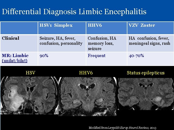 Differential Diagnosis Limbic Encephalitis HSV 1 Simplex HHV 6 VZV Zoster Clinical Seizure, HA,