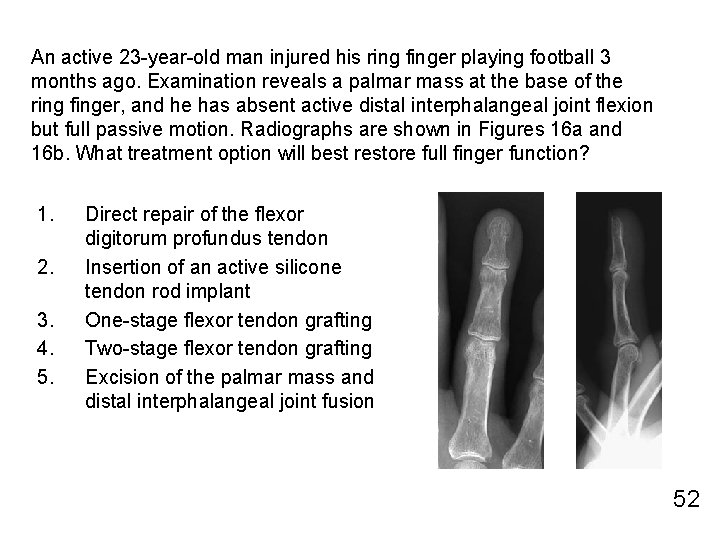 An active 23 -year-old man injured his ring finger playing football 3 months ago.