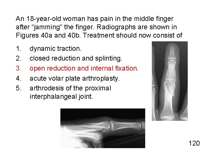 An 18 -year-old woman has pain in the middle finger after “jamming” the finger.