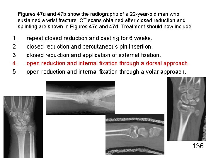 Figures 47 a and 47 b show the radiographs of a 22 -year-old man