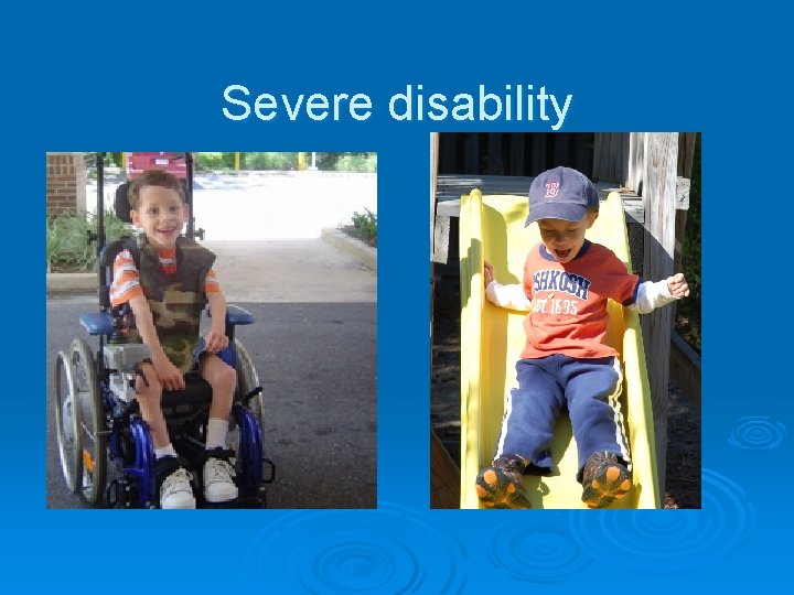 Severe disability 