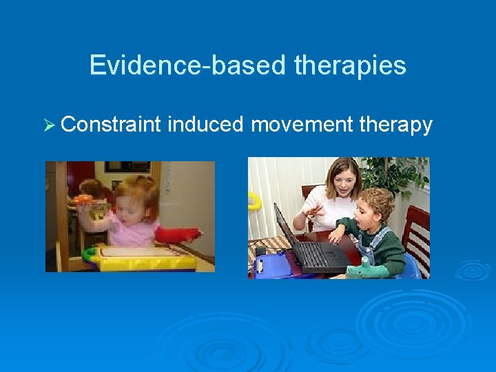Evidence-based therapies Ø Constraint induced movement therapy 