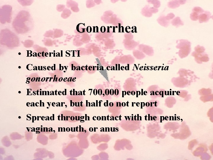 Gonorrhea • Bacterial STI • Caused by bacteria called Neisseria gonorrhoeae • Estimated that