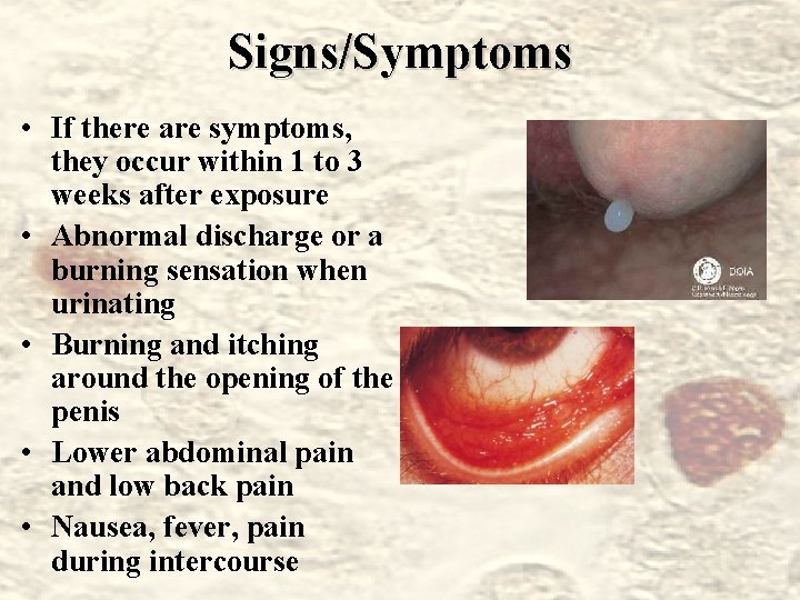 Signs/Symptoms • If there are symptoms, they occur within 1 to 3 weeks after