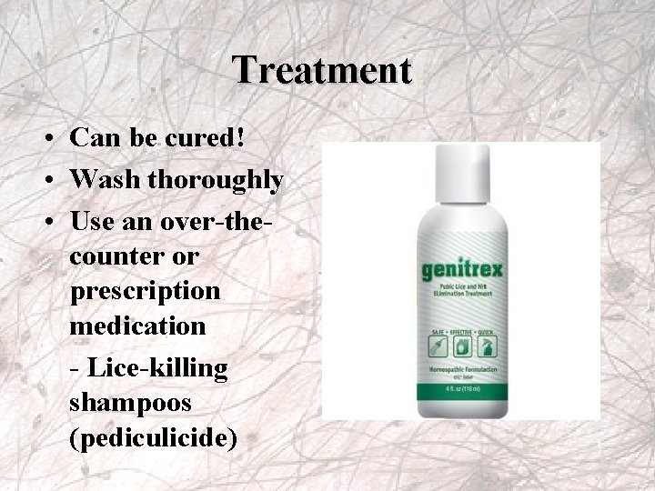 Treatment • Can be cured! • Wash thoroughly • Use an over-thecounter or prescription