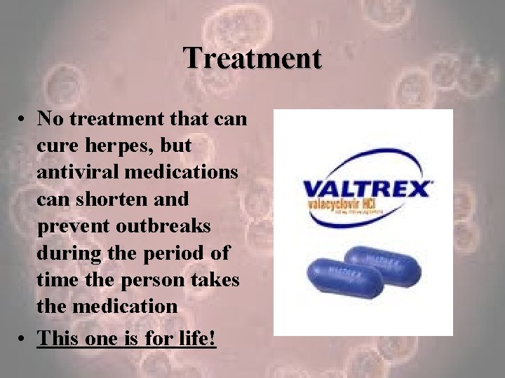 Treatment • No treatment that can cure herpes, but antiviral medications can shorten and