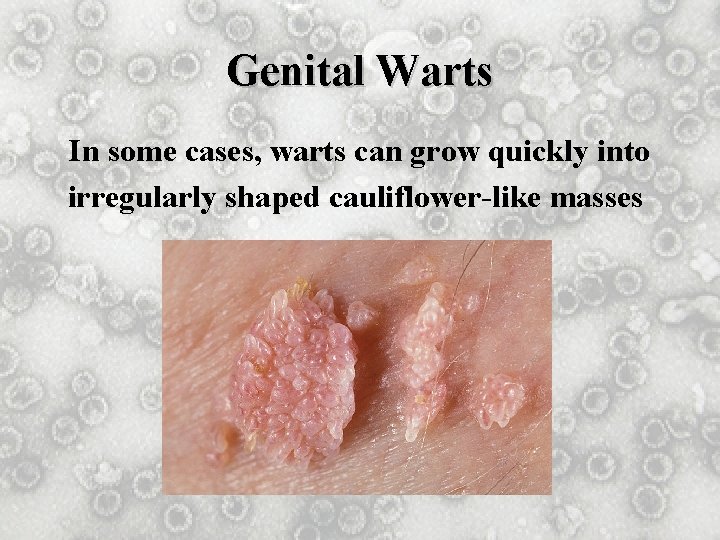 Genital Warts In some cases, warts can grow quickly into irregularly shaped cauliflower-like masses