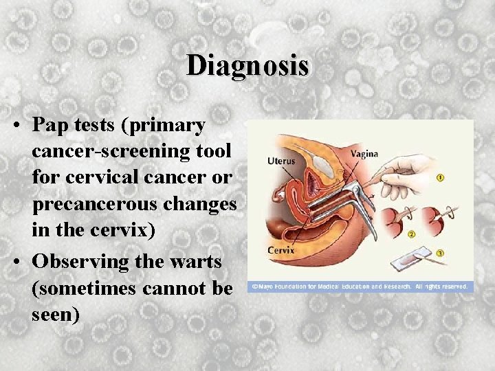 Diagnosis • Pap tests (primary cancer-screening tool for cervical cancer or precancerous changes in