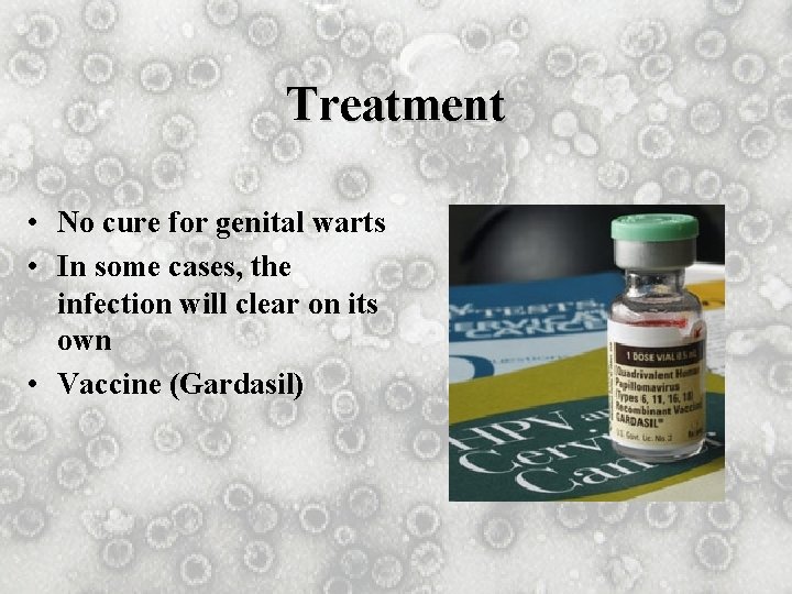 Treatment • No cure for genital warts • In some cases, the infection will