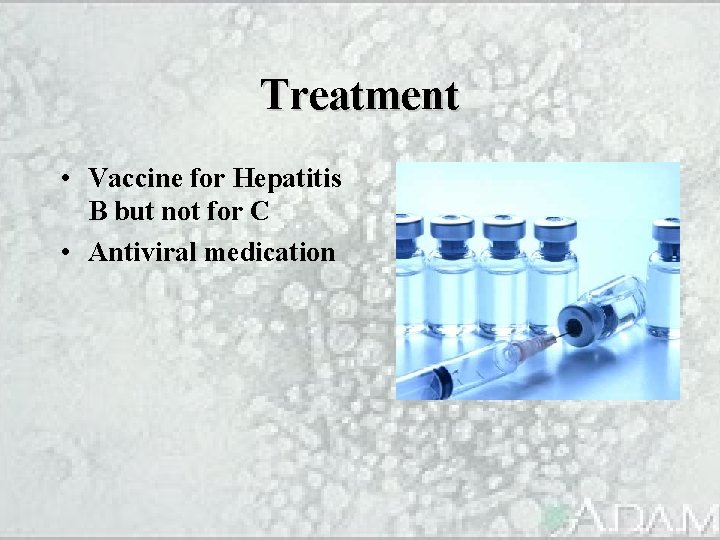 Treatment • Vaccine for Hepatitis B but not for C • Antiviral medication 