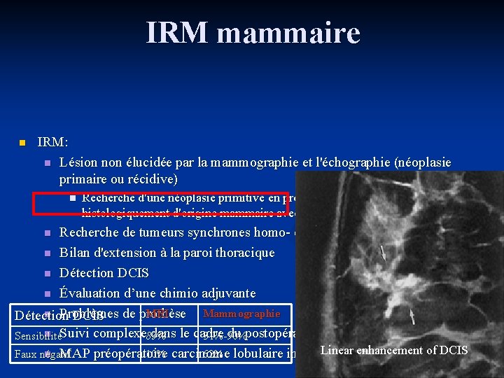 IRM mammaire n IRM: n Lésion non élucidée par la mammographie et l'échographie (néoplasie