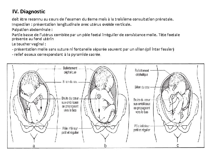 IV. Diagnostic doit être reconnu au cours de l’examen du 8 eme mois à