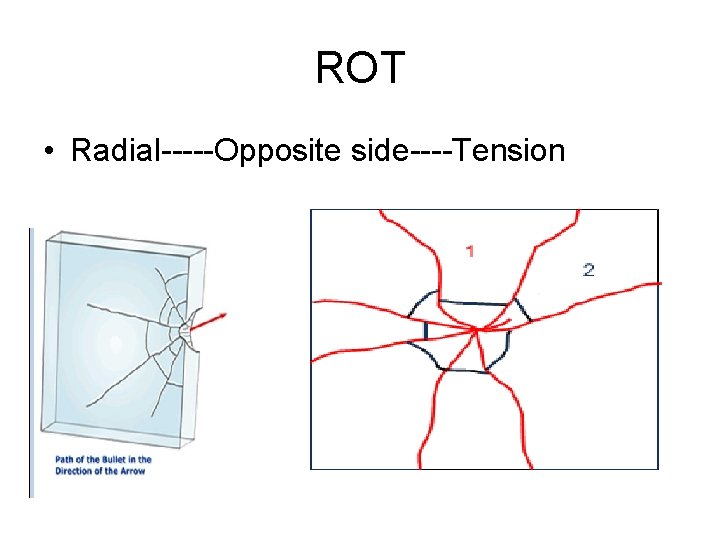 ROT • Radial-----Opposite side----Tension 