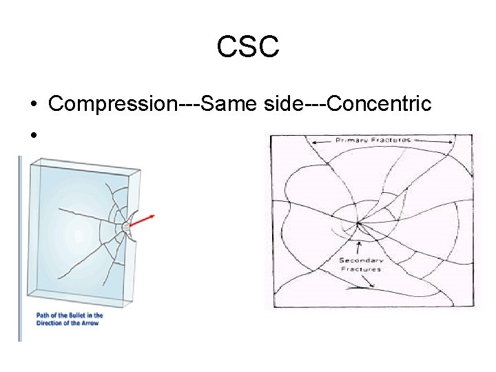 CSC • Compression---Same side---Concentric • 