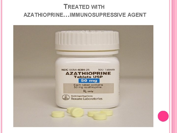 TREATED WITH AZATHIOPRINE…IMMUNOSUPRESSIVE AGENT 