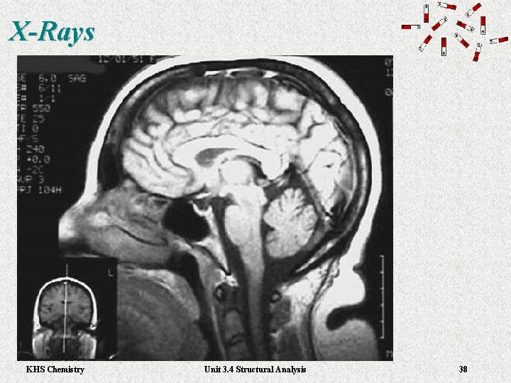X-Rays KHS Chemistry Unit 3. 4 Structural Analysis 38 X-Rays KHS Chemistry Unit 3. 4 Structural Analysis 38