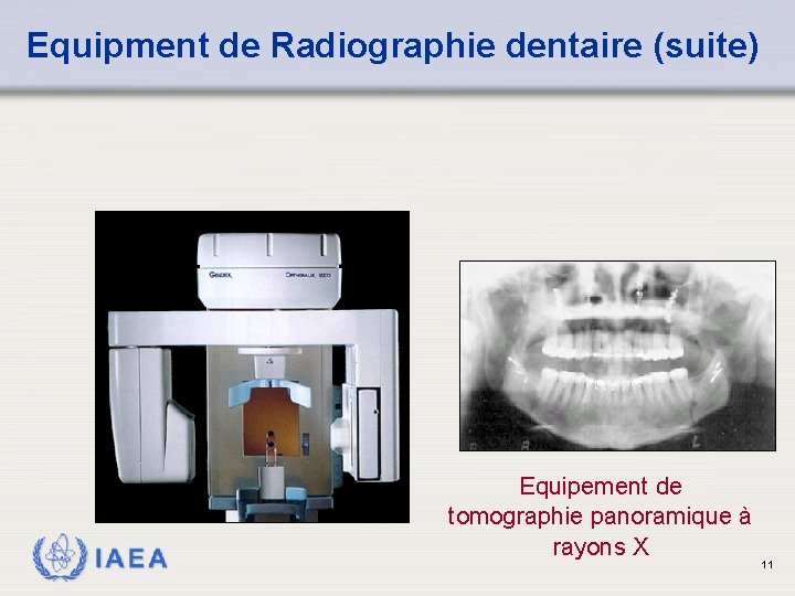 Equipment de Radiographie dentaire (suite) IAEA Equipement de tomographie panoramique à rayons X 11