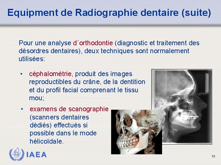 Equipment de Radiographie dentaire (suite) Pour une analyse d´orthodontie (diagnostic et traitement des désordres