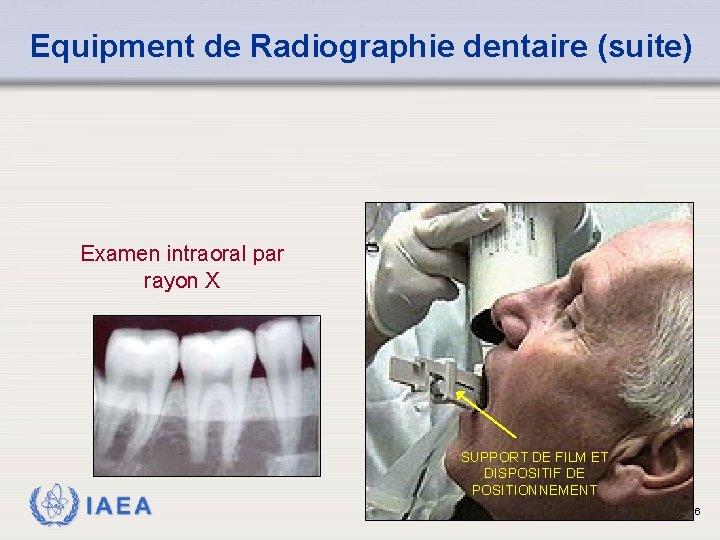 Equipment de Radiographie dentaire (suite) Examen intraoral par rayon X IAEA SUPPORT DE FILM