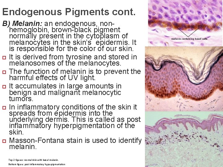 Endogenous Pigments cont. B) Melanin: an endogenous, nonhemoglobin, brown-black pigment normally present in the