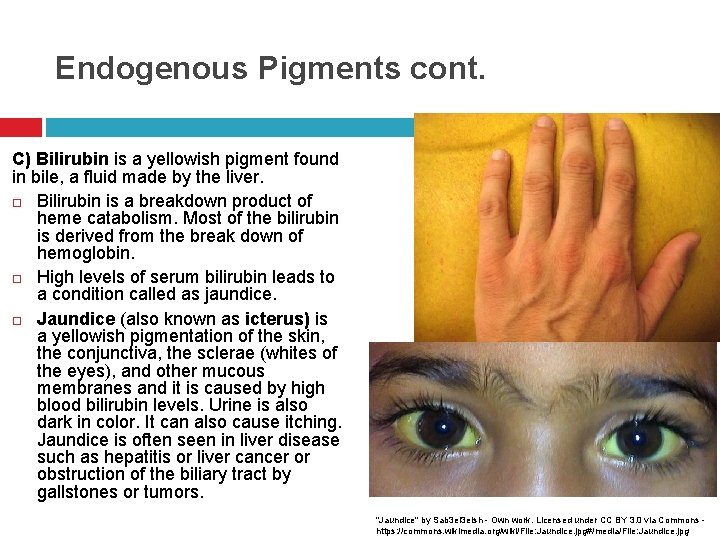 Endogenous Pigments cont. C) Bilirubin is a yellowish pigment found in bile, a fluid