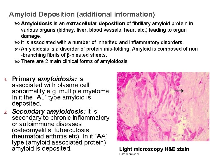 Amyloid Deposition (additional information) Amyloidosis is an extracellular deposition of fibrillary amyloid protein in