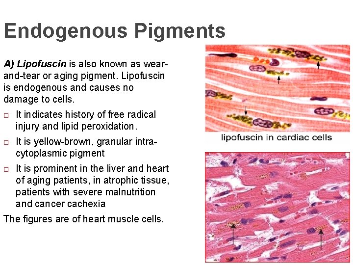 Endogenous Pigments A) Lipofuscin is also known as wearand-tear or aging pigment. Lipofuscin is