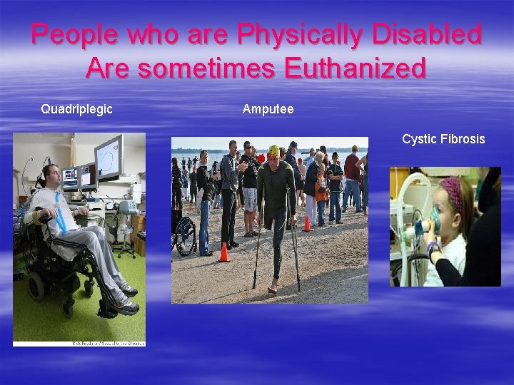 People who are Physically Disabled Are sometimes Euthanized Quadriplegic Amputee Cystic Fibrosis 