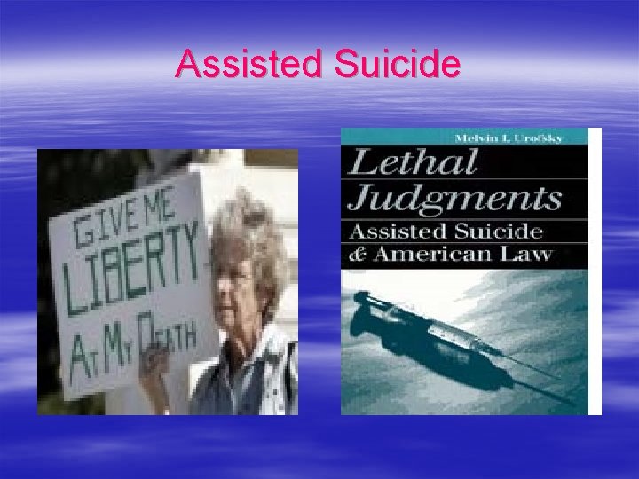 Assisted Suicide 