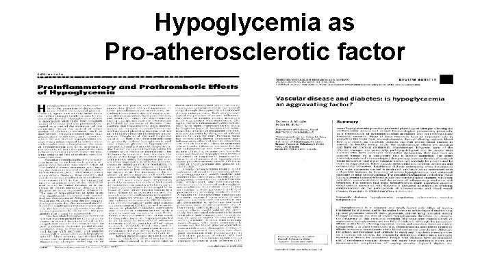 Hypoglycemia as Pro-atherosclerotic factor Hypoglycemia as Pro-atherosclerotic factor