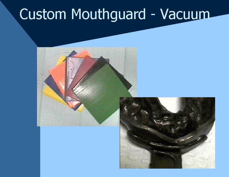 Custom Mouthguard - Vacuum Custom Mouthguard - Vacuum