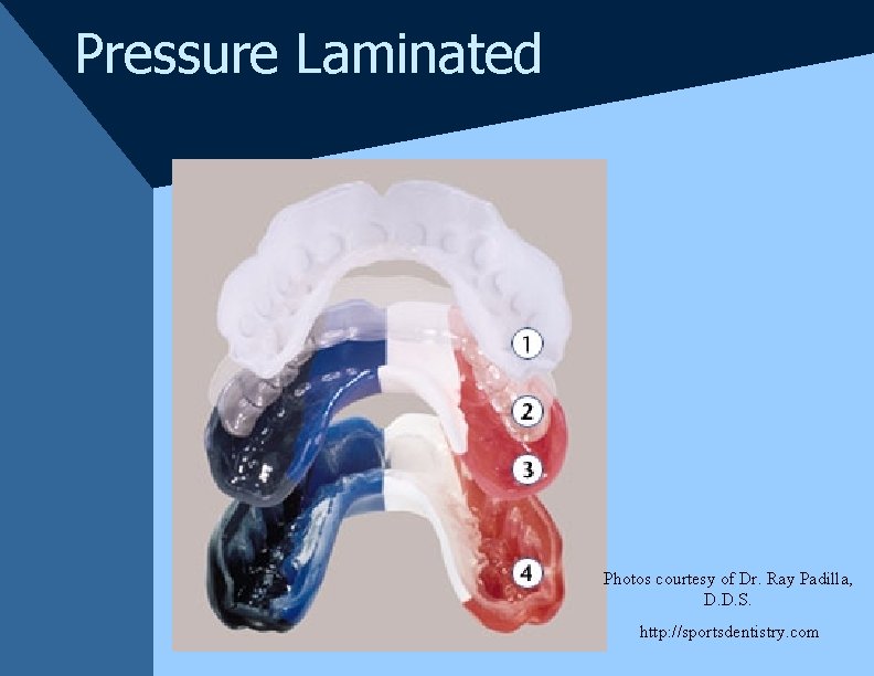 Pressure Laminated Photos courtesy of Dr. Ray Padilla, D. D. S. http: //sportsdentistry. com Pressure Laminated Photos courtesy of Dr. Ray Padilla, D. D. S. http: //sportsdentistry. com
