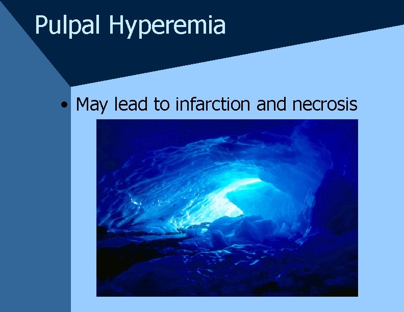 Pulpal Hyperemia • May lead to infarction and necrosis Pulpal Hyperemia • May lead to infarction and necrosis