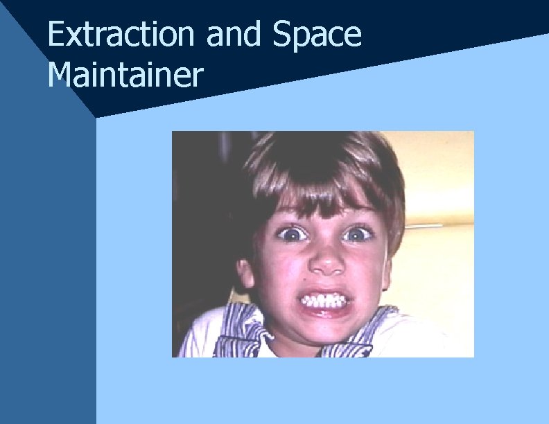 Extraction and Space Maintainer Extraction and Space Maintainer