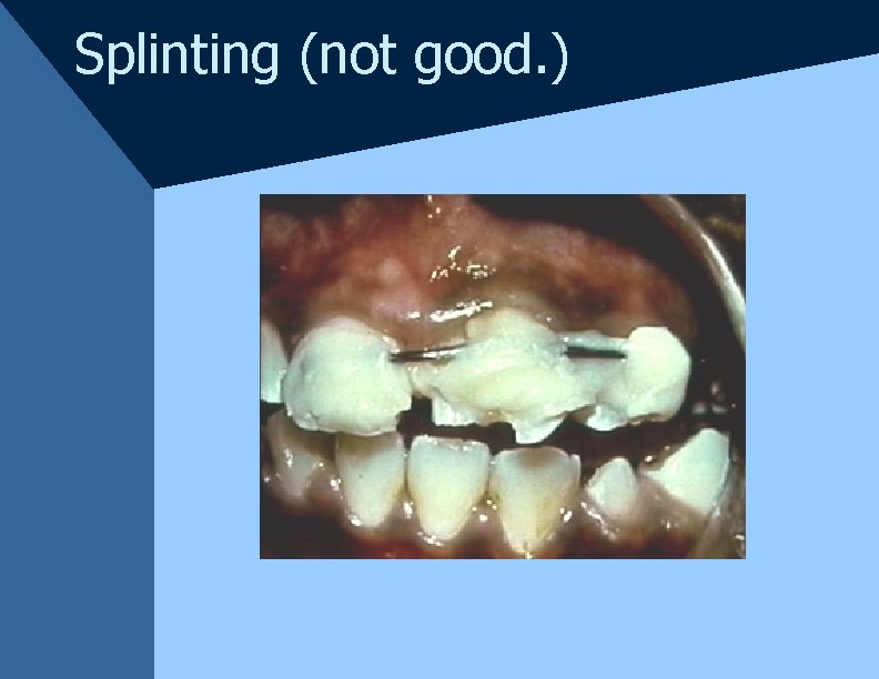 Splinting (not good. ) Splinting (not good. )