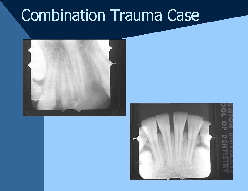Combination Trauma Case Combination Trauma Case