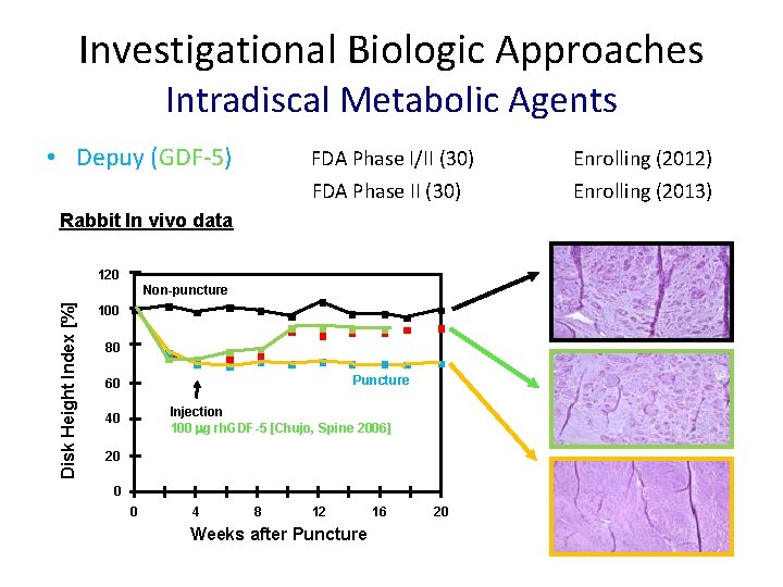 Investigational Biologic Approaches Intradiscal Metabolic Agents • Depuy (GDF-5) FDA Phase I/II (30) FDA