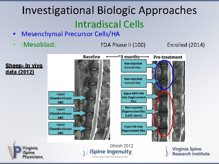 Investigational Biologic Approaches Intradiscal Cells • Mesenchymal Precursor Cells/HA • (Mesoblast) FDA Phase II