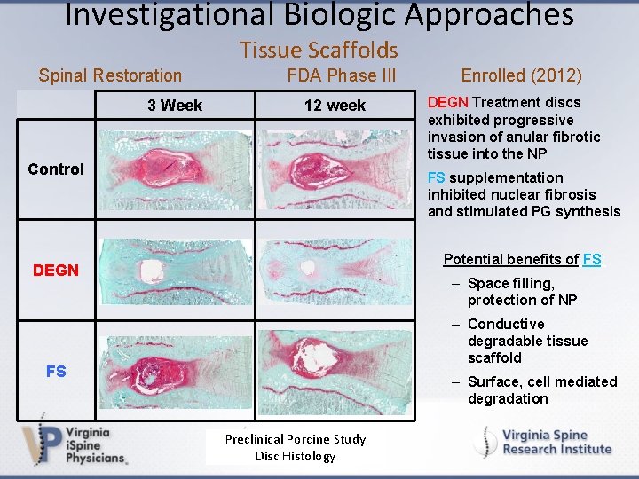 Investigational Biologic Approaches Tissue Scaffolds Spinal Restoration 3 Week FDA Phase III 12 week