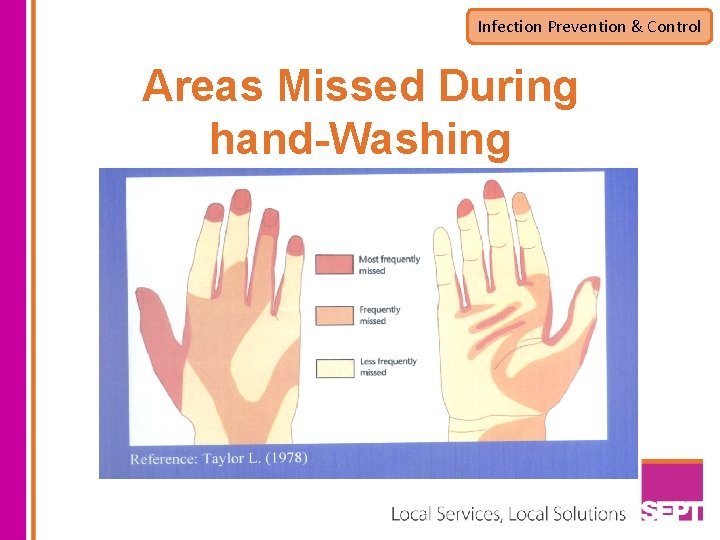 Infection Prevention & Control Areas Missed During hand-Washing 