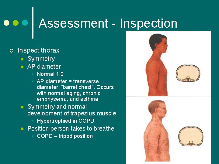 Assessment - Inspection ¢ Inspect thorax l l Symmetry AP diameter • Normal 1: