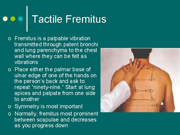Tactile Fremitus ¢ ¢ Fremitus is a palpable vibration transmitted through patent bronchi and