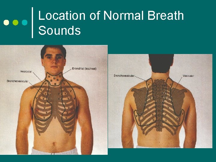 Location of Normal Breath Sounds 