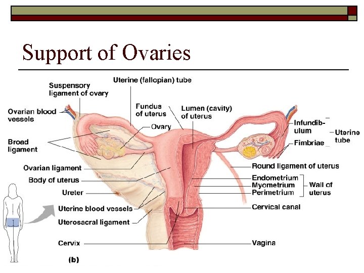 Support of Ovaries 