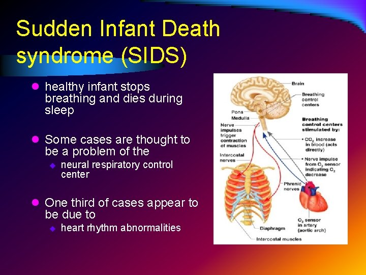 Sudden Infant Death syndrome (SIDS) l healthy infant stops breathing and dies during sleep